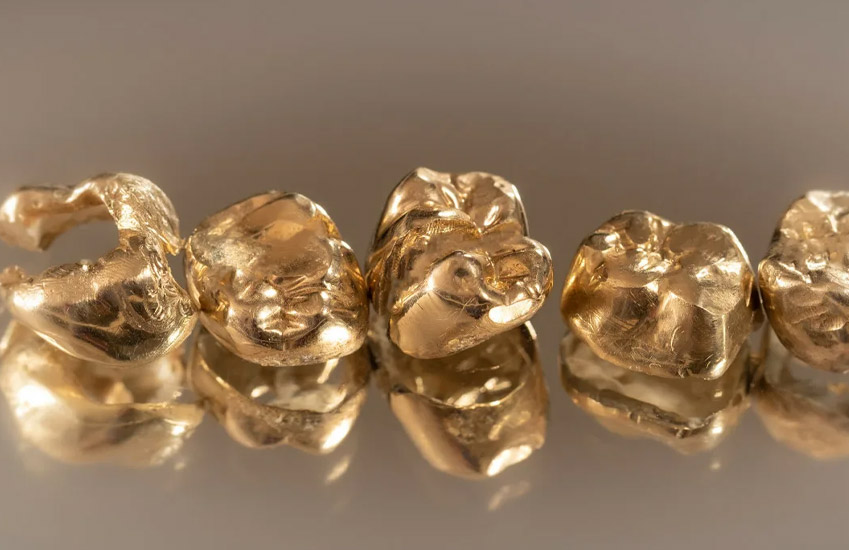 Скупка стоматологического золота